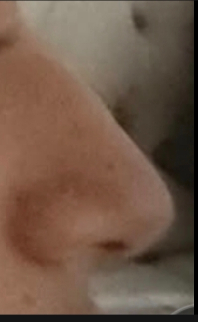428