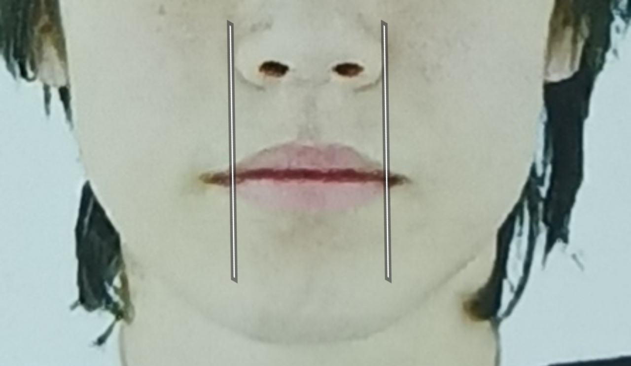 1000083414