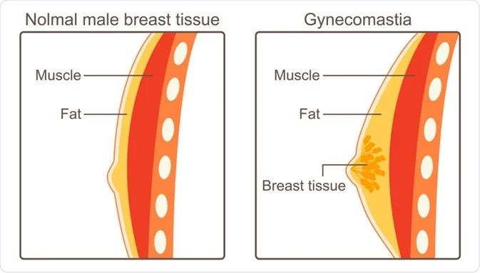 Gyno image