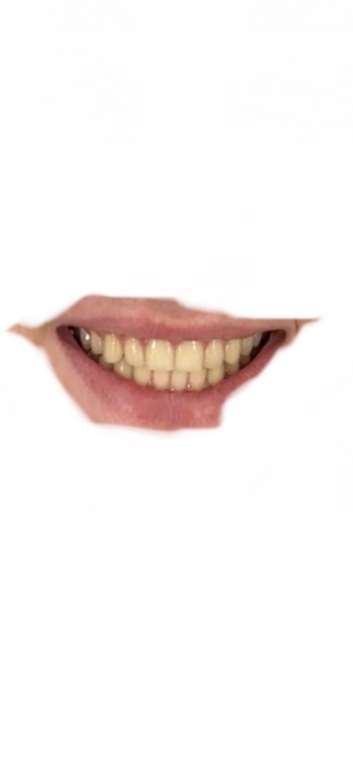 IMG 2751