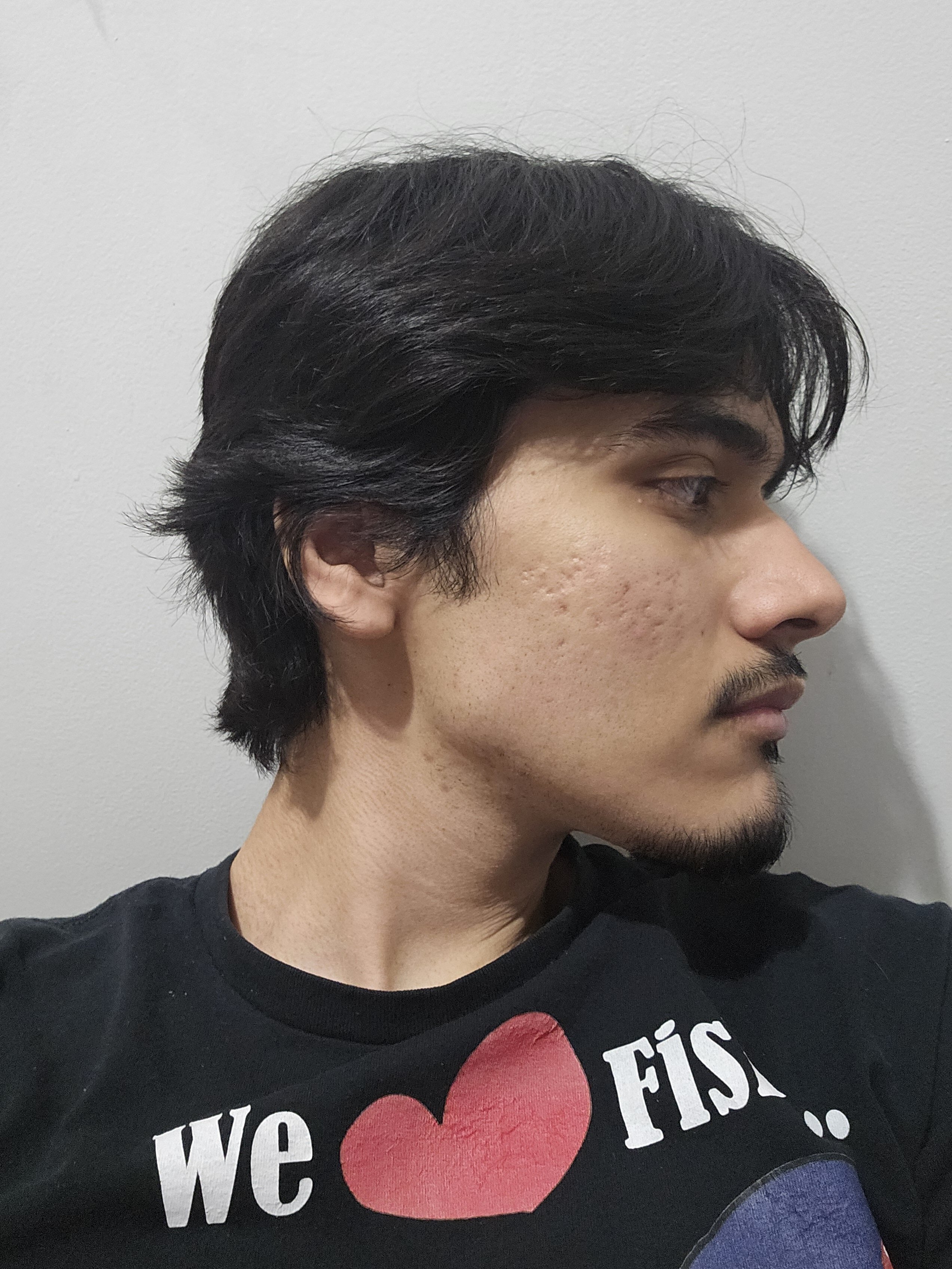 1000060928