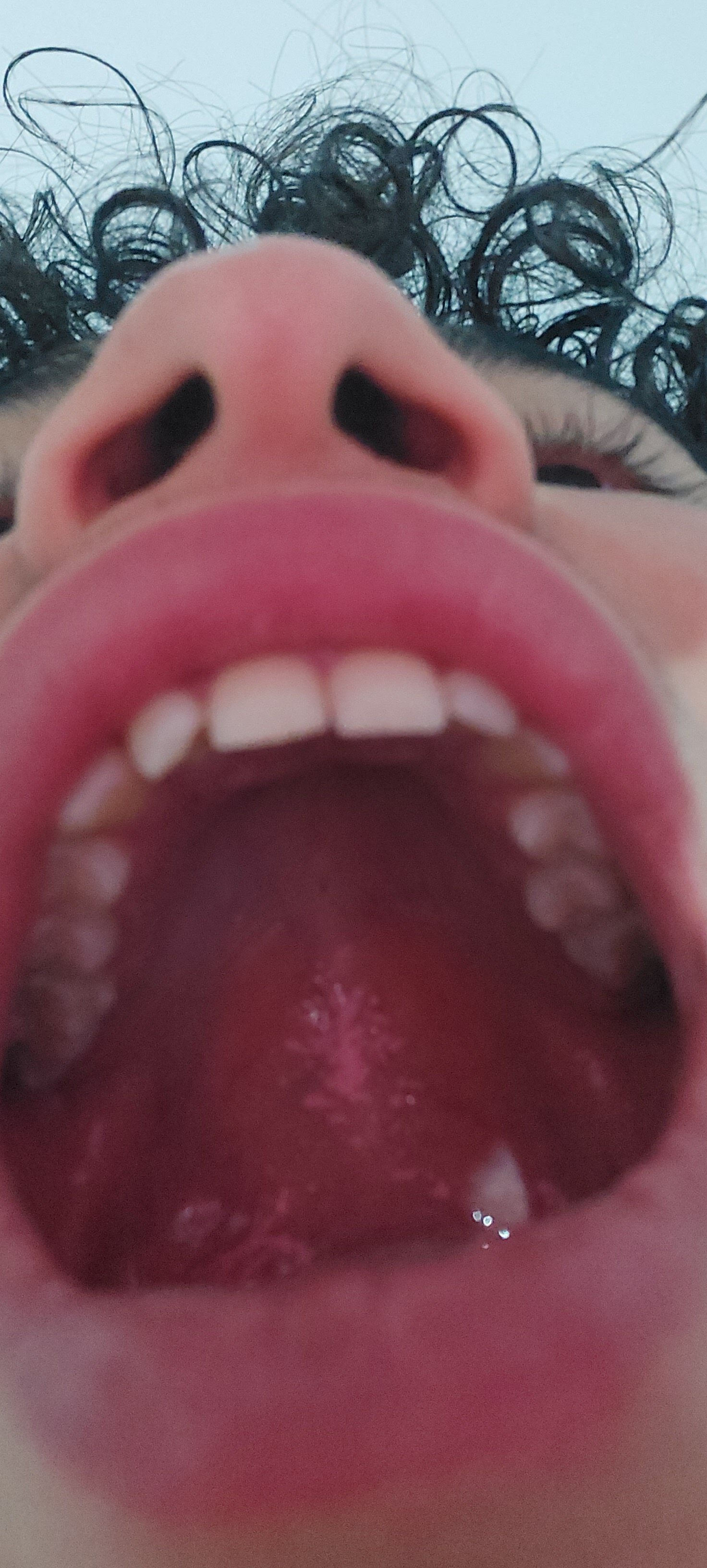 1000015644