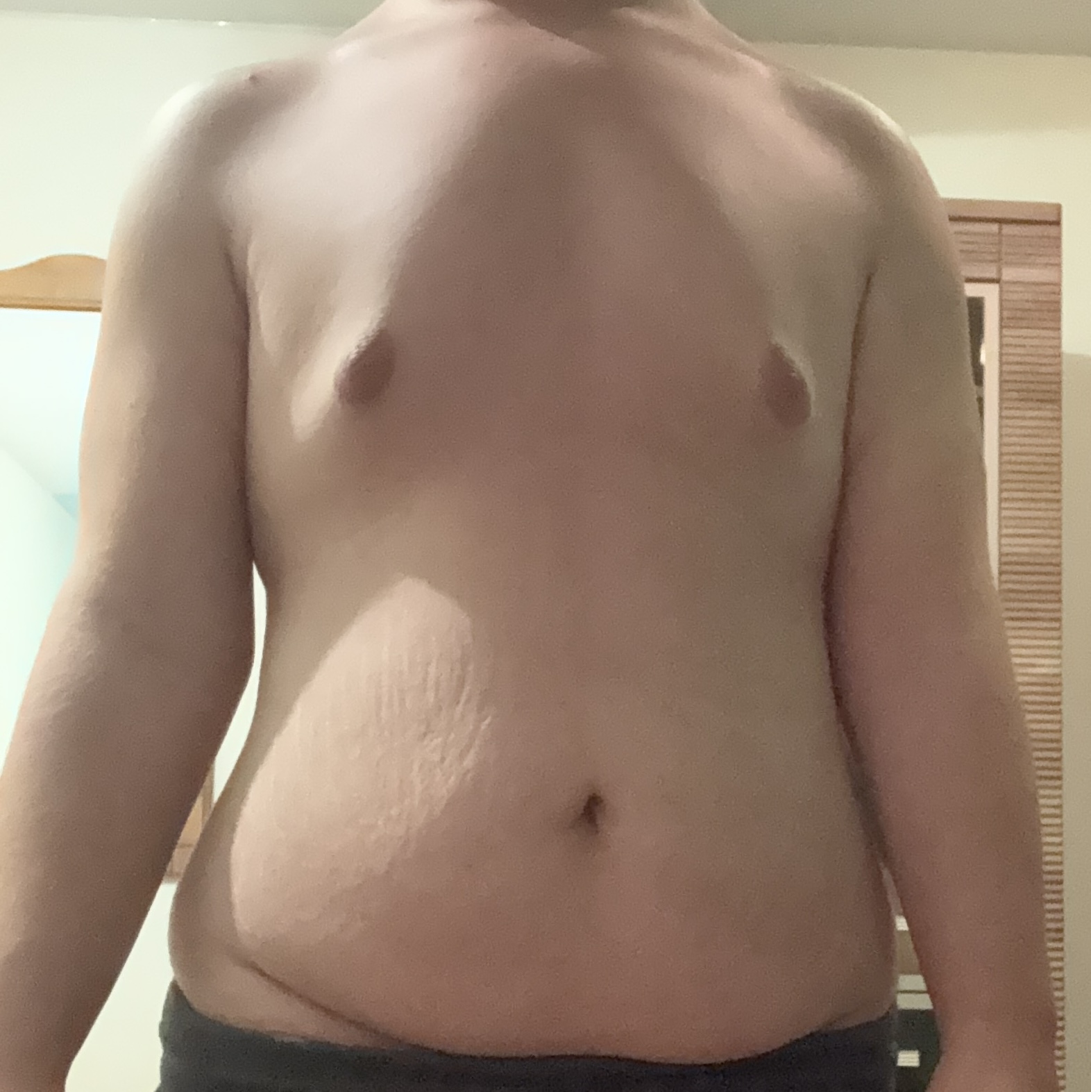 IMG 0838
