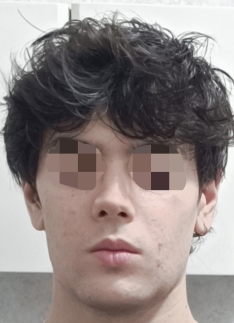1000128499