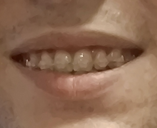 1000128538
