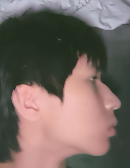 1000019318