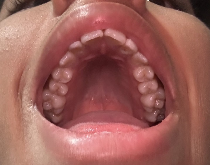 IMG 2530