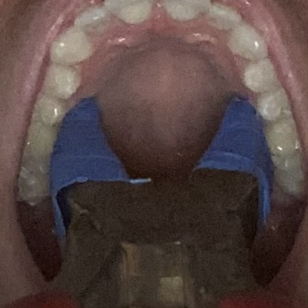 37230