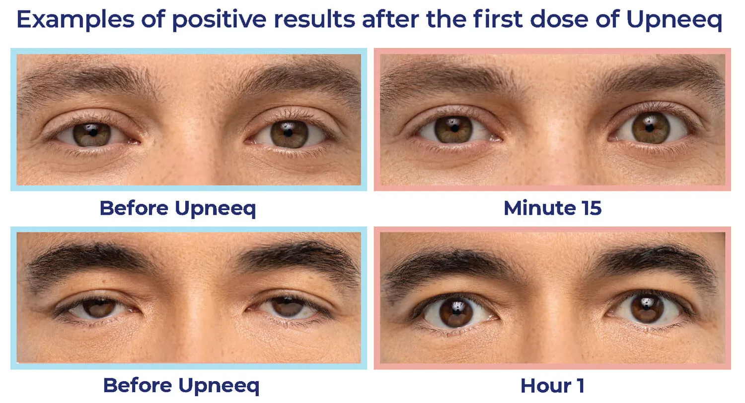 Upneeq before and after men 1500W