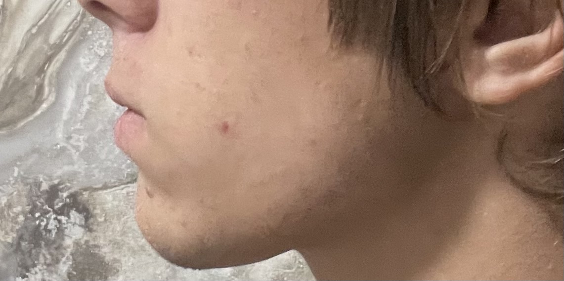 IMG 0399