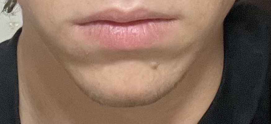 IMG 0396