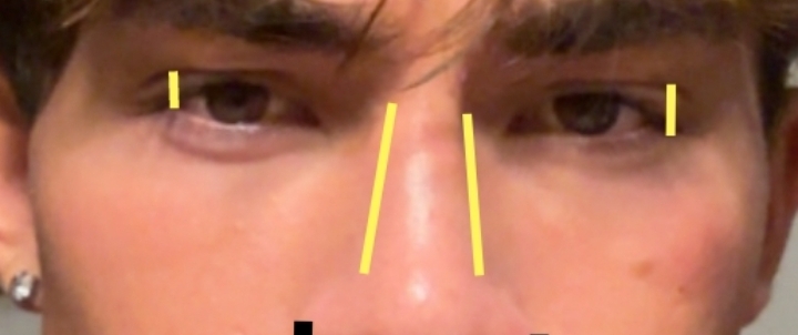 1000024632