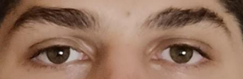 1000107766