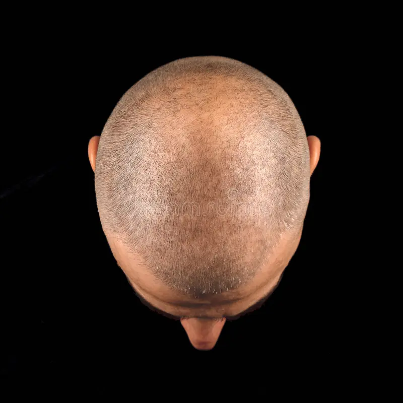 Close up top view bald man s head short stubble isolated black background close up top view b
