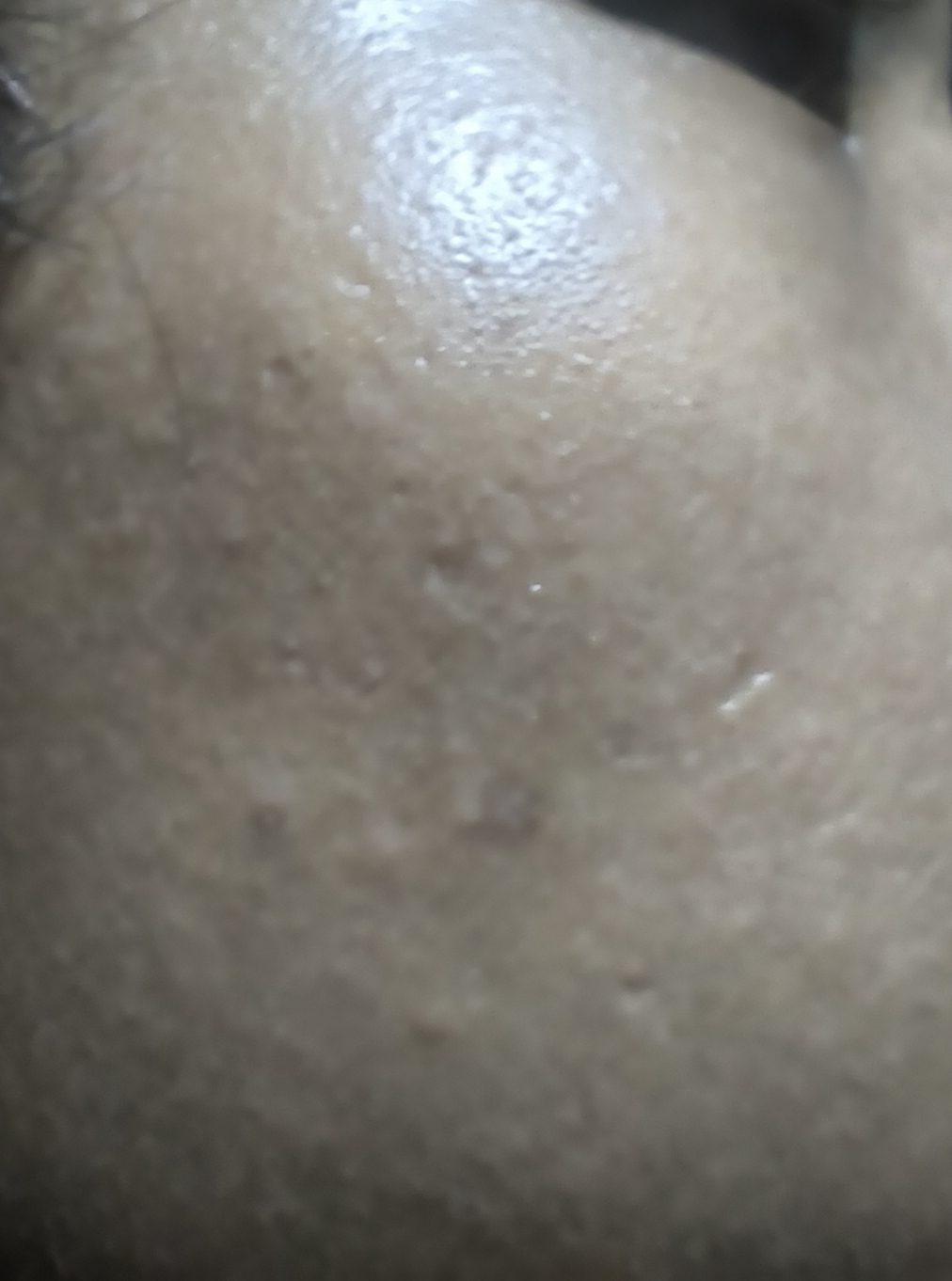 1000016449