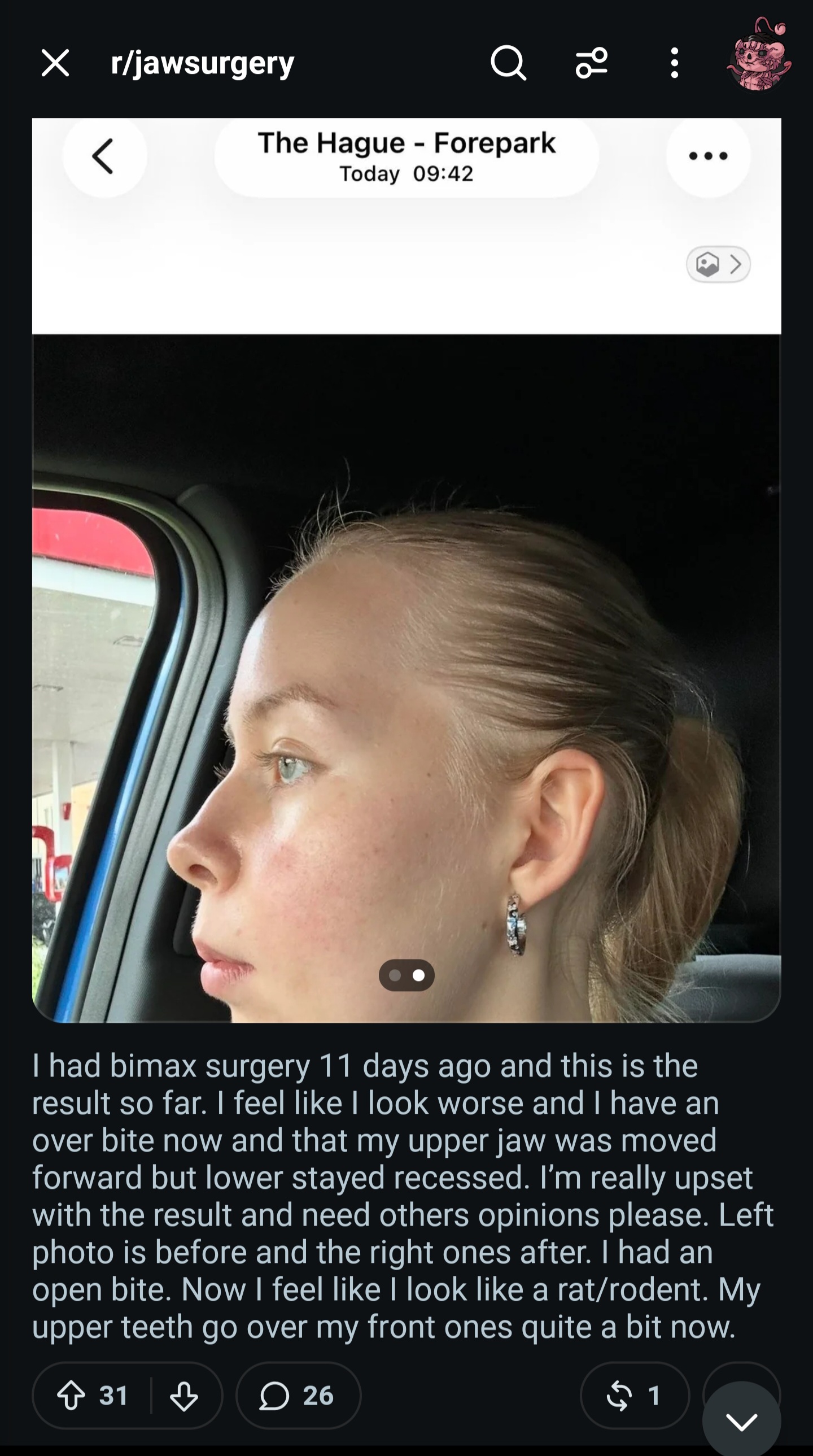1000182353