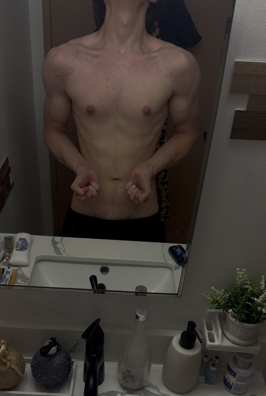 IMG 1645