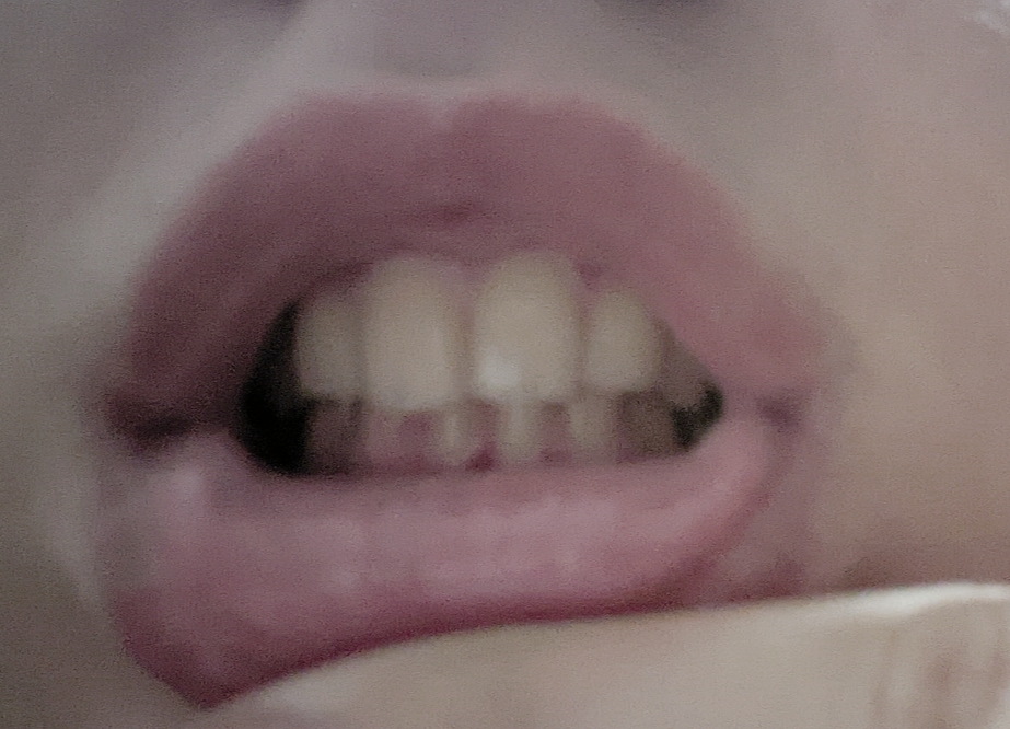 1000045263