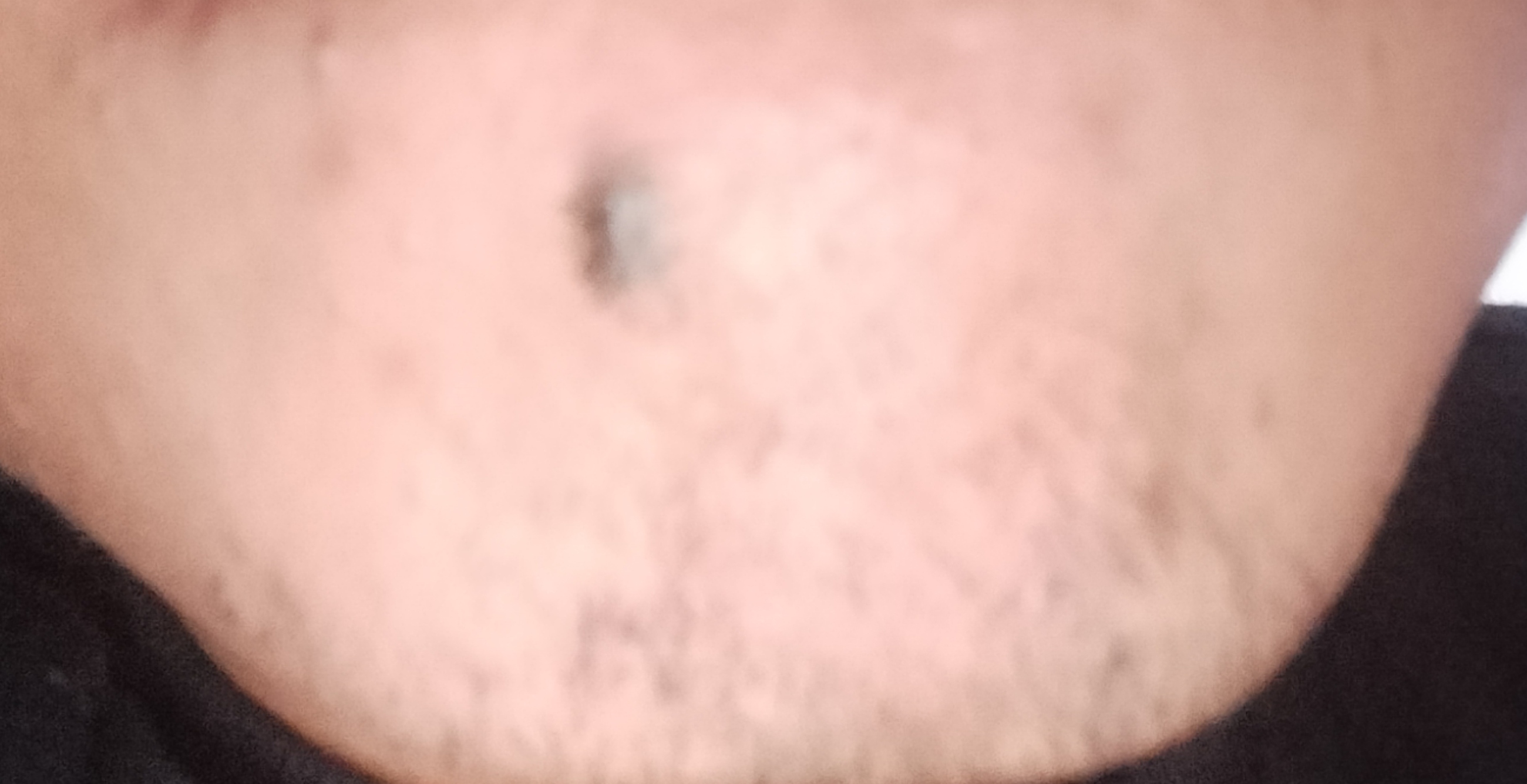 1000056855