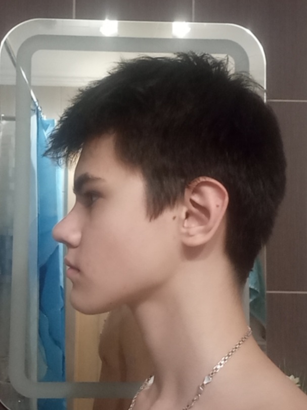 1000014265