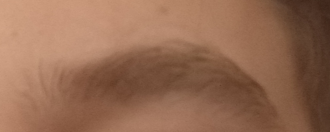 1000083818