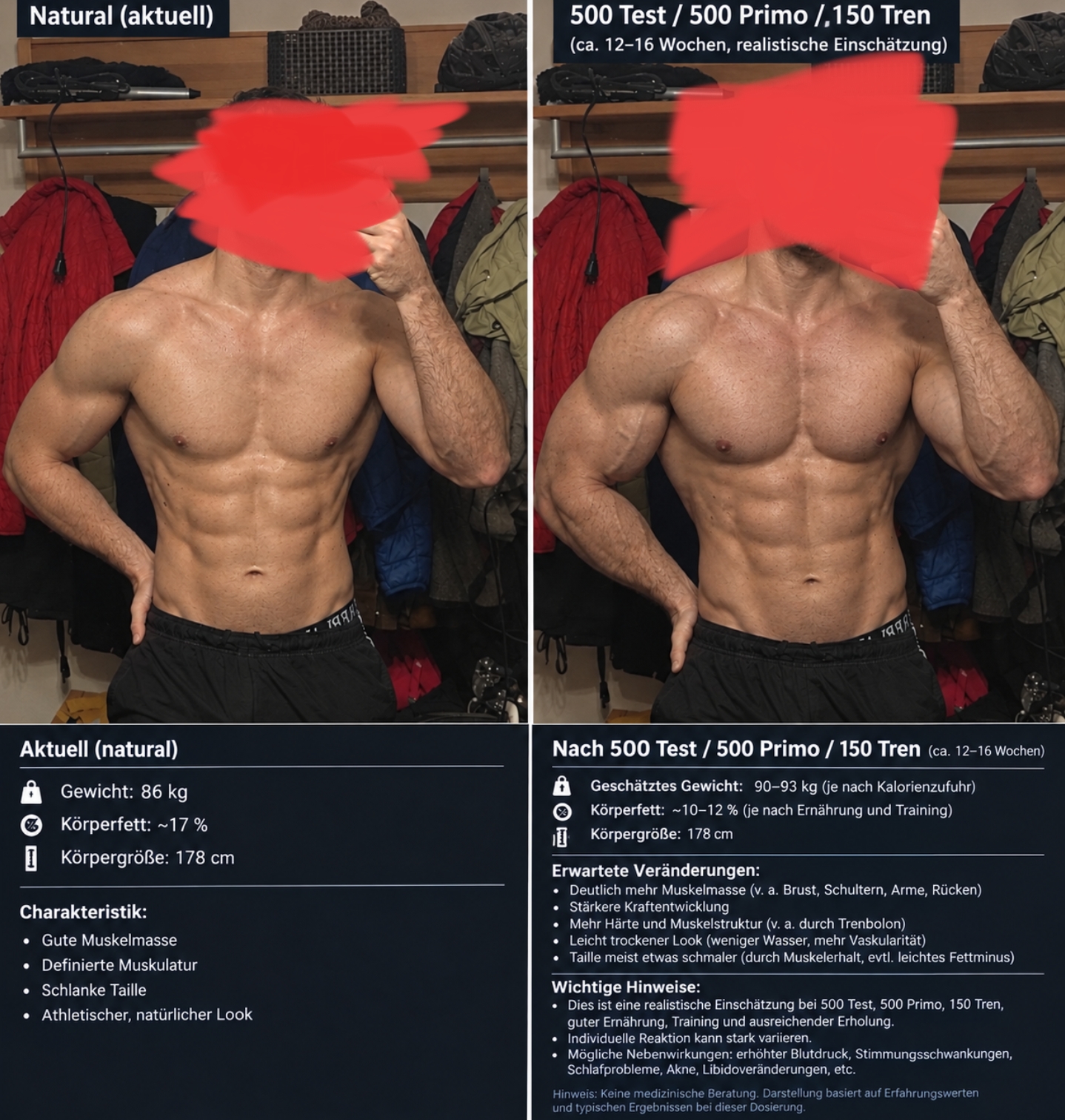 1000092321