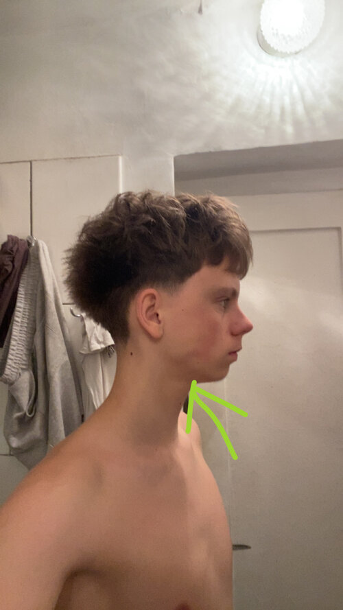 IMG 1635