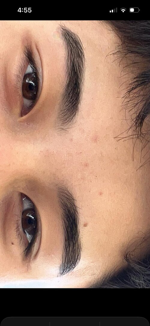 eye area 2.jpeg