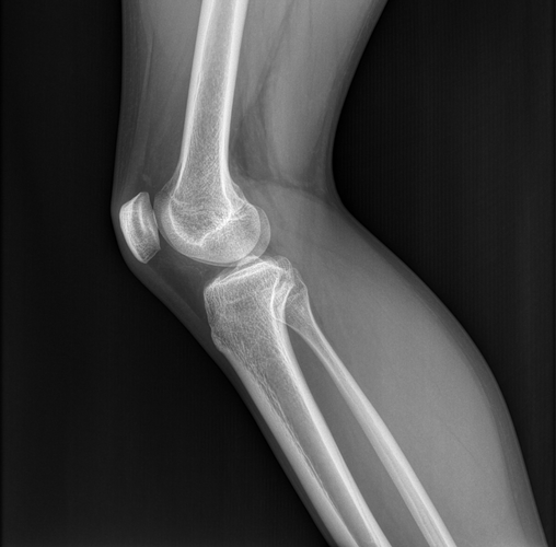 rodilla.png
