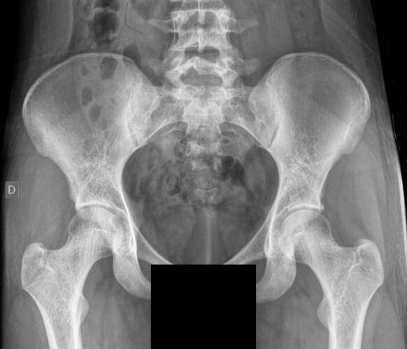 pelvis.jpg