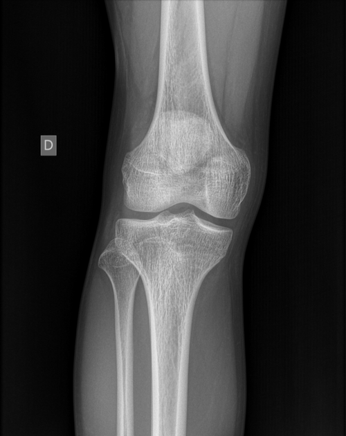 rodilla2.png