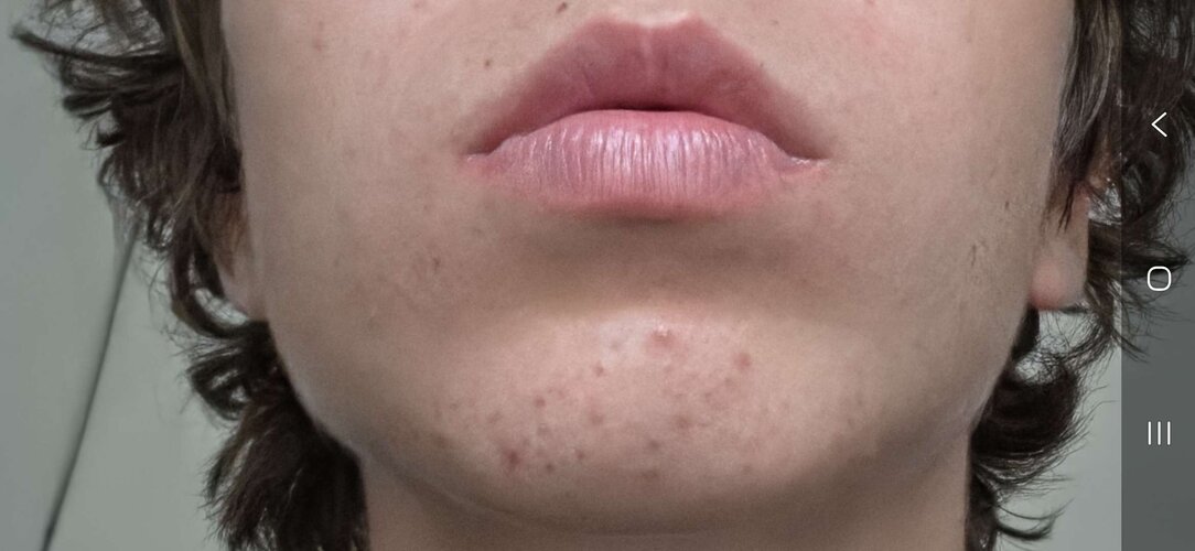 jaw4.jpg