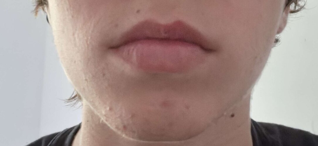 jaw3.jpg