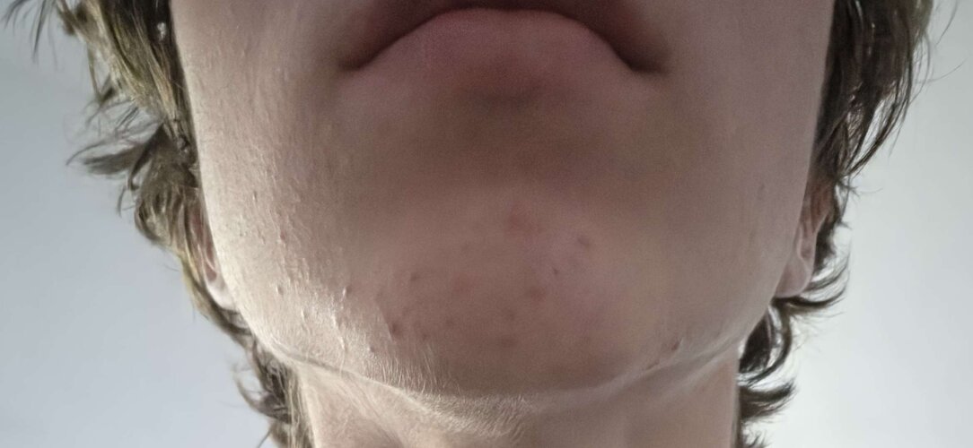 jaw2.jpg