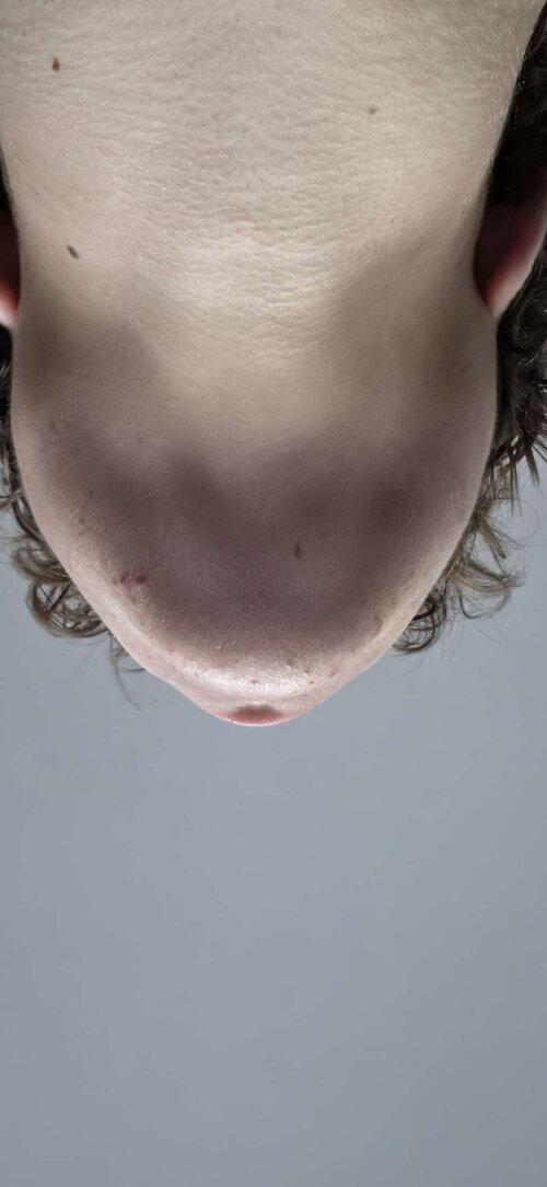 jaw1.jpg