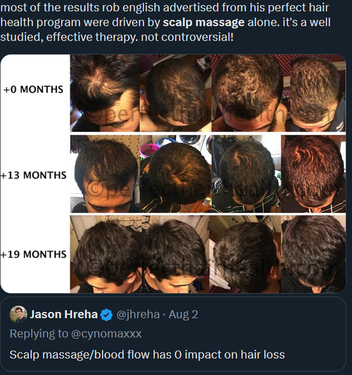 Librewolf xcom   scalp massage   Search  X  Original profi NWgnht