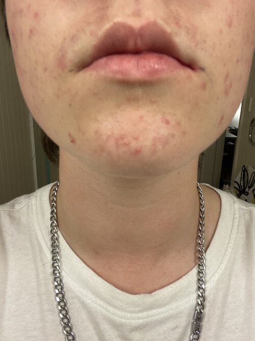 IMG 0918