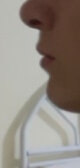 before.jpg