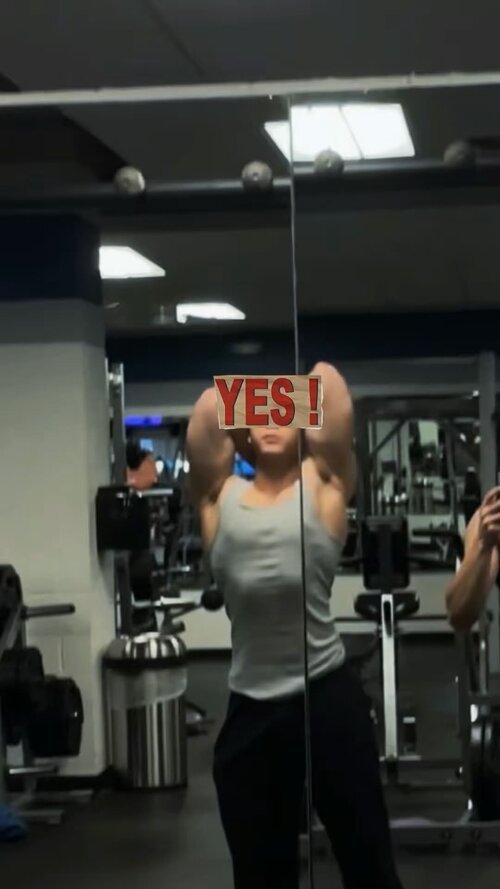 Early gyno 1.jpg