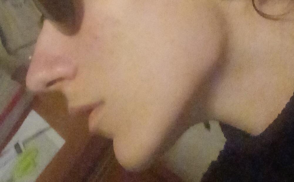 1000134781