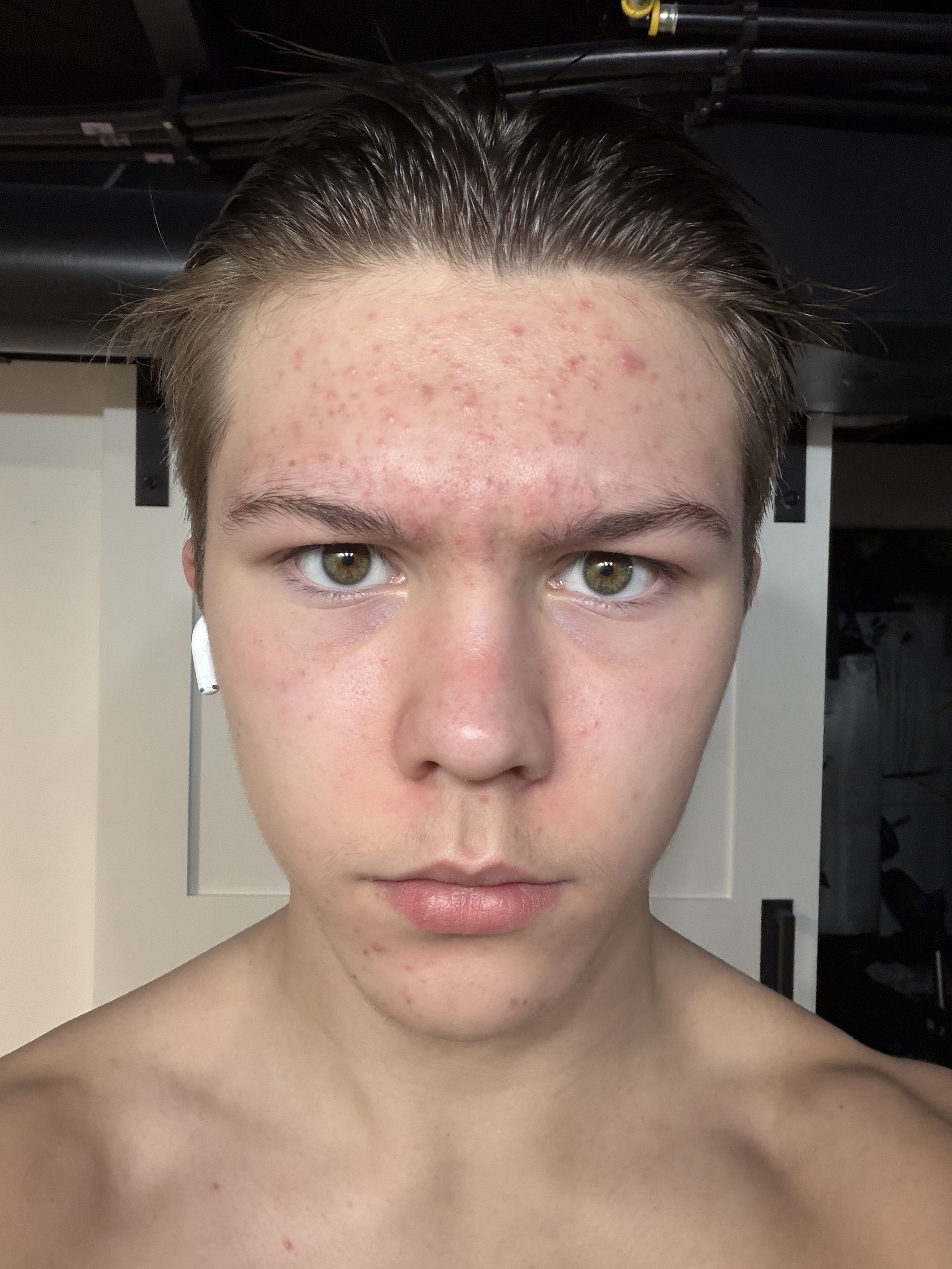 IMG 3642