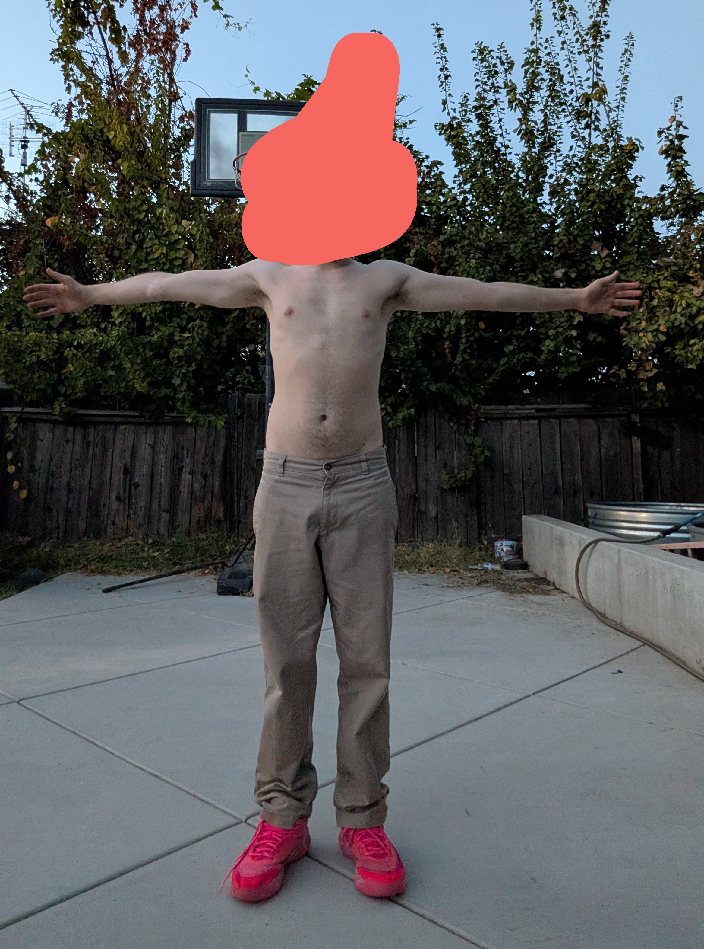 1000012524