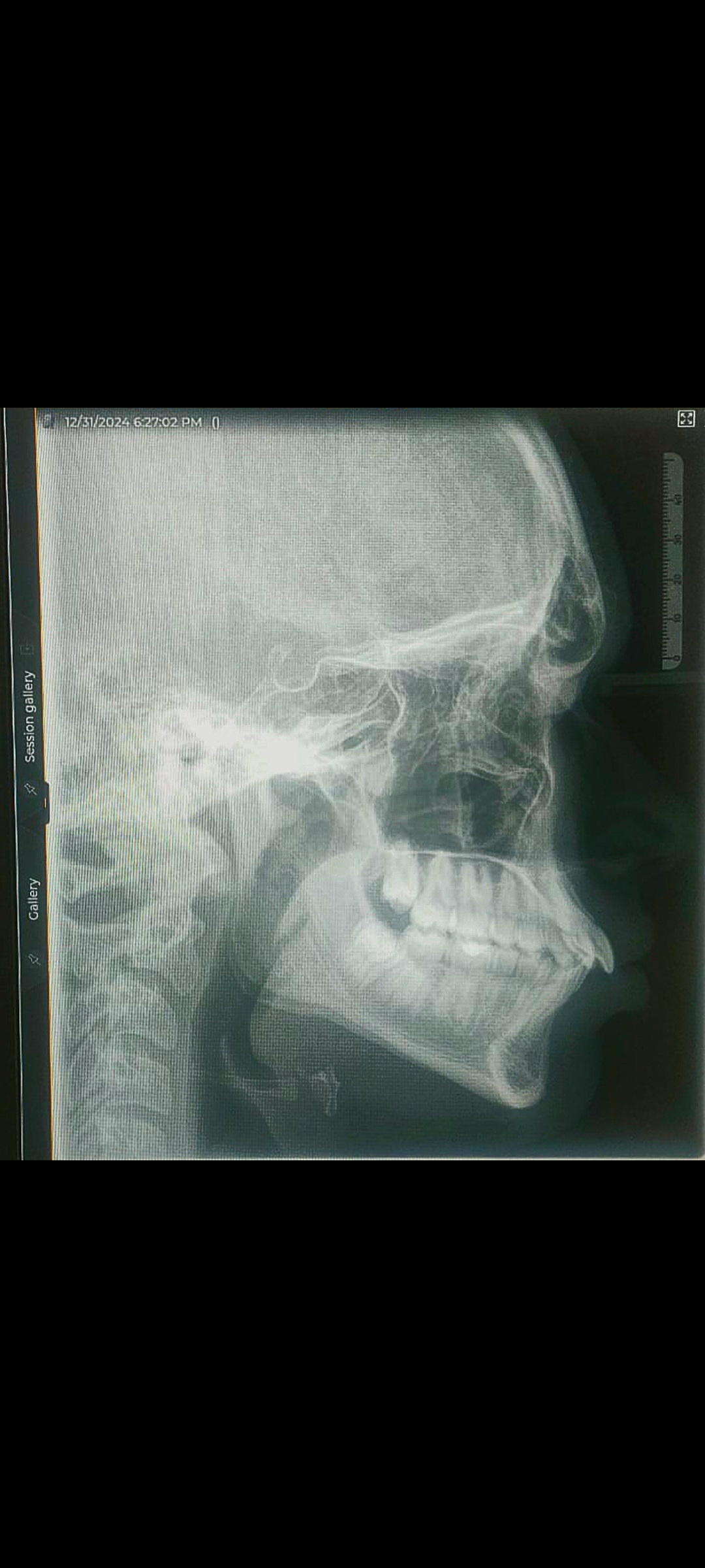 1000590527