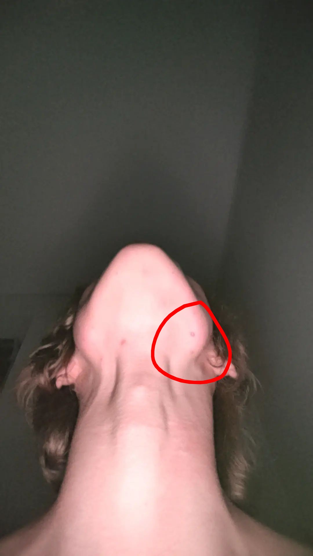 1000003993