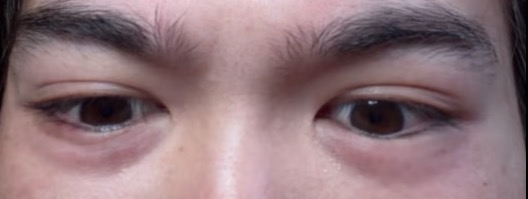 IMG 0486