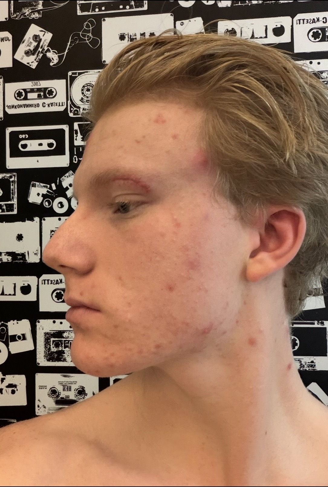 IMG 0381