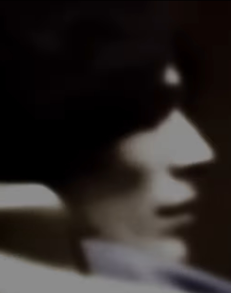 1000135176