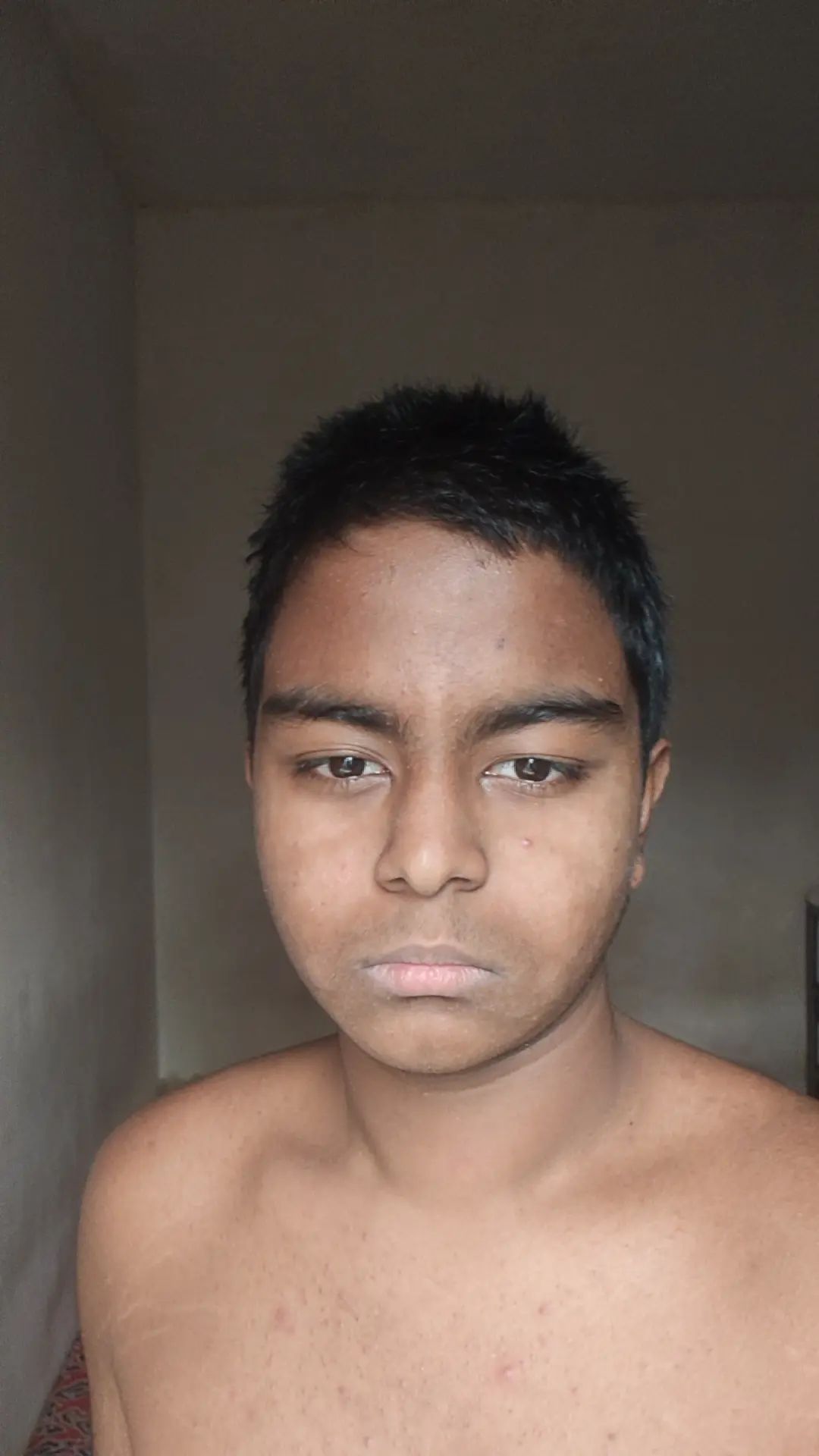1000331392