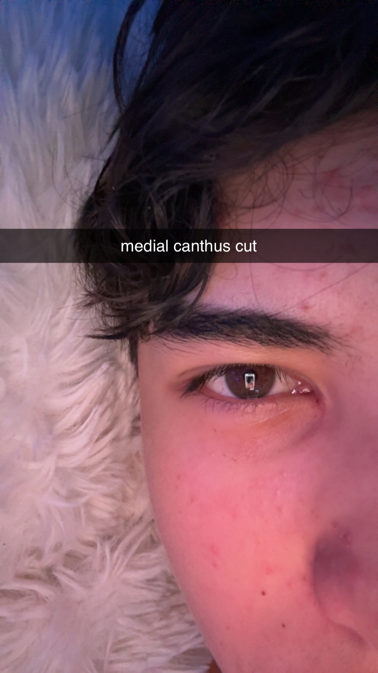 rate me ( and eyes ) | Looksmax.org - Men's Self-Improvement & Aesthetics