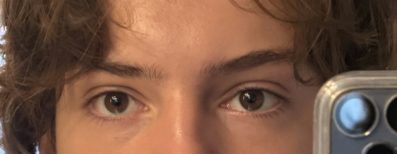 Eye area 02-10-2026.jpg
